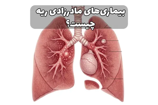 بیماری‌های مادرزادی ریه