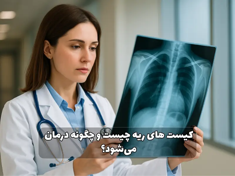 کیست های ریه