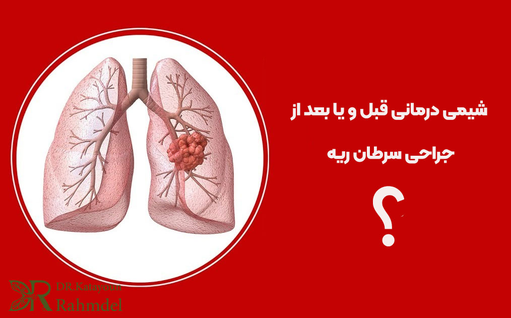 شیمی درمانی در جراحی سرطان ریه
