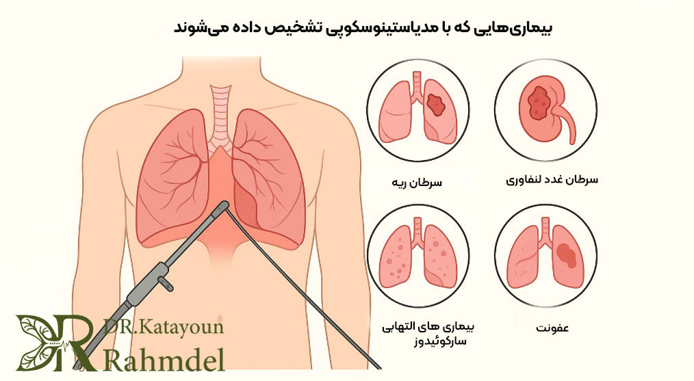 بیماری‌هایی که با مدیاستینوسکوپی تشخیص داده می‌شوند