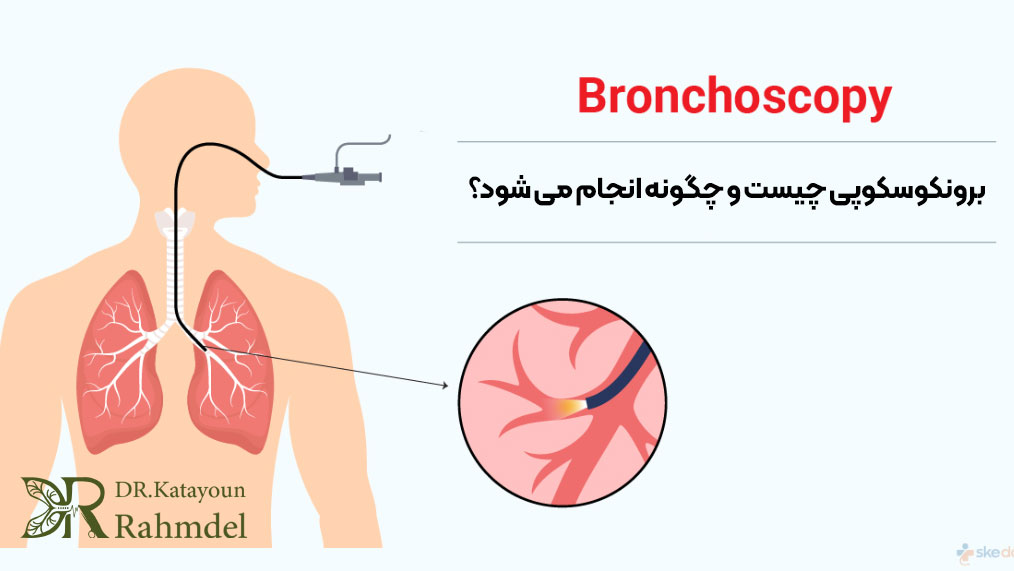 برونکوسکوپی