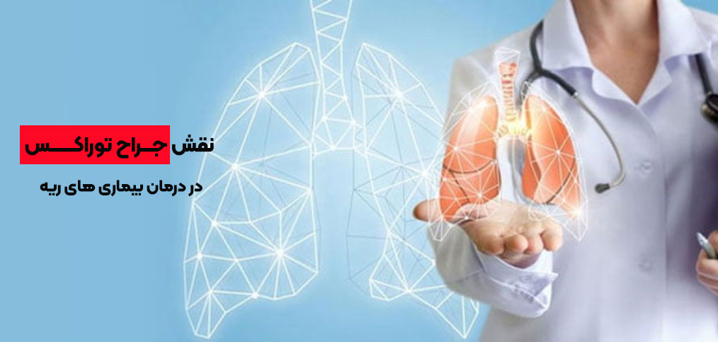 نقش جراح توراکس در درمان بیماری های ریه
