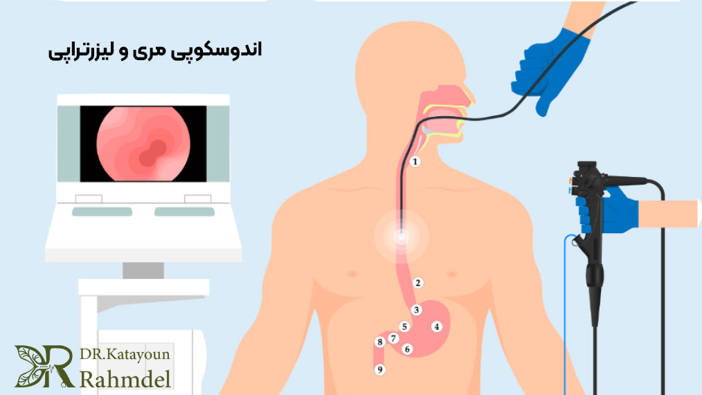اندوسکوپی مری