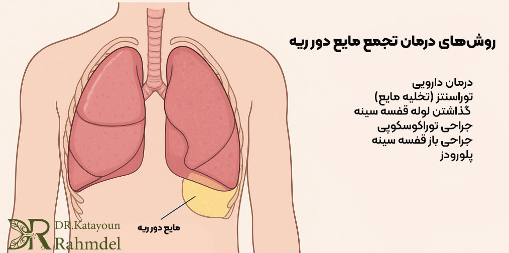 روشهای تشخیص مایع دور ریه
