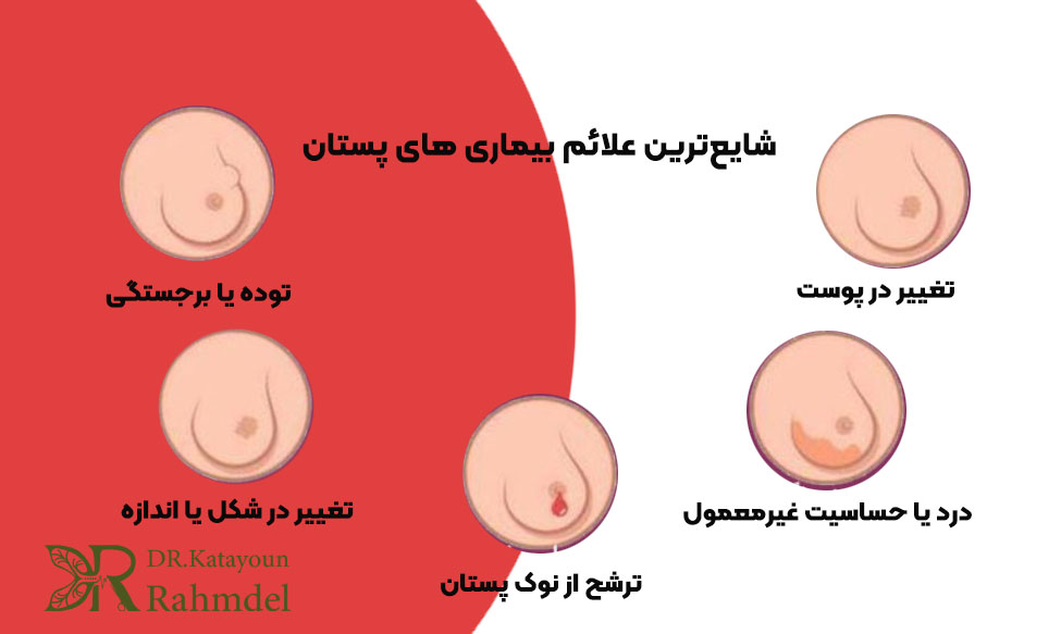 شایع‌ترین علائم بیماری های پستان