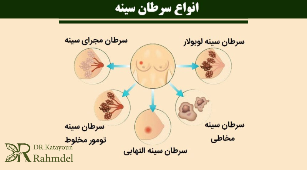 انواع سرطان پستان