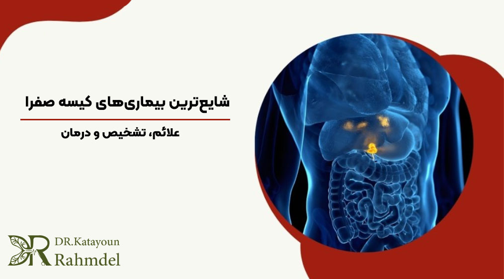 بیماری های کیسه صفرا