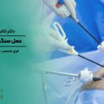 عمل کیسه صفرا