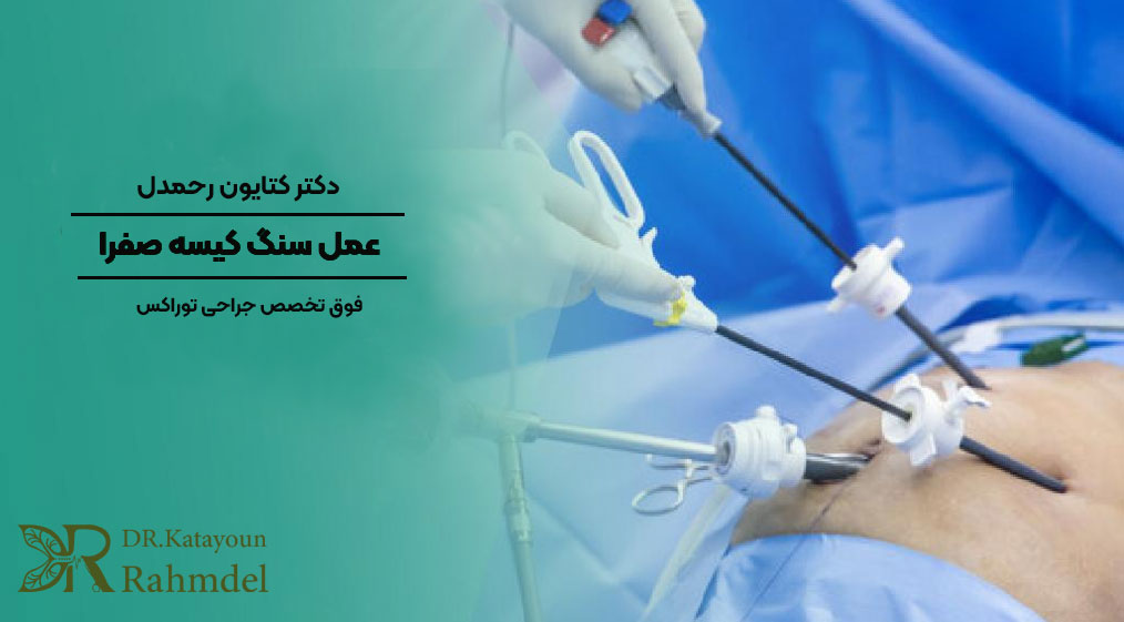 عمل کیسه صفرا