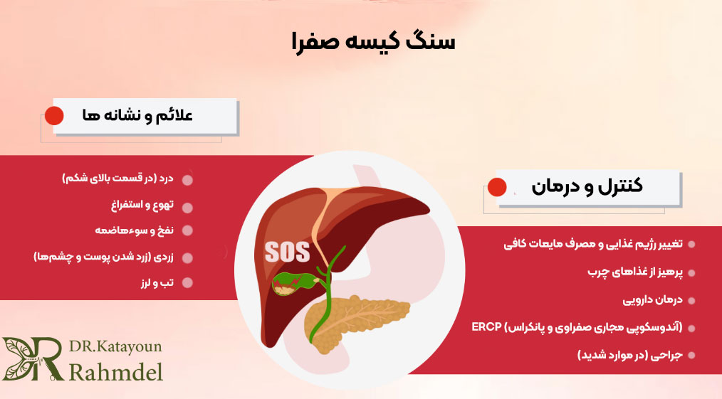 علائم سنگ کیسه صفرا