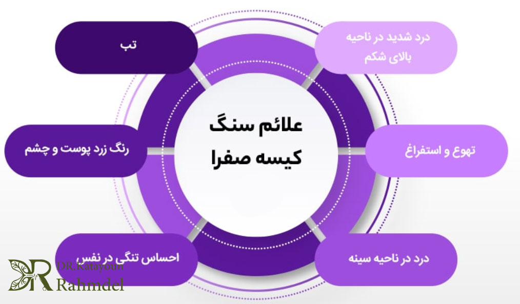 علائم سنگ کیسه صفرا