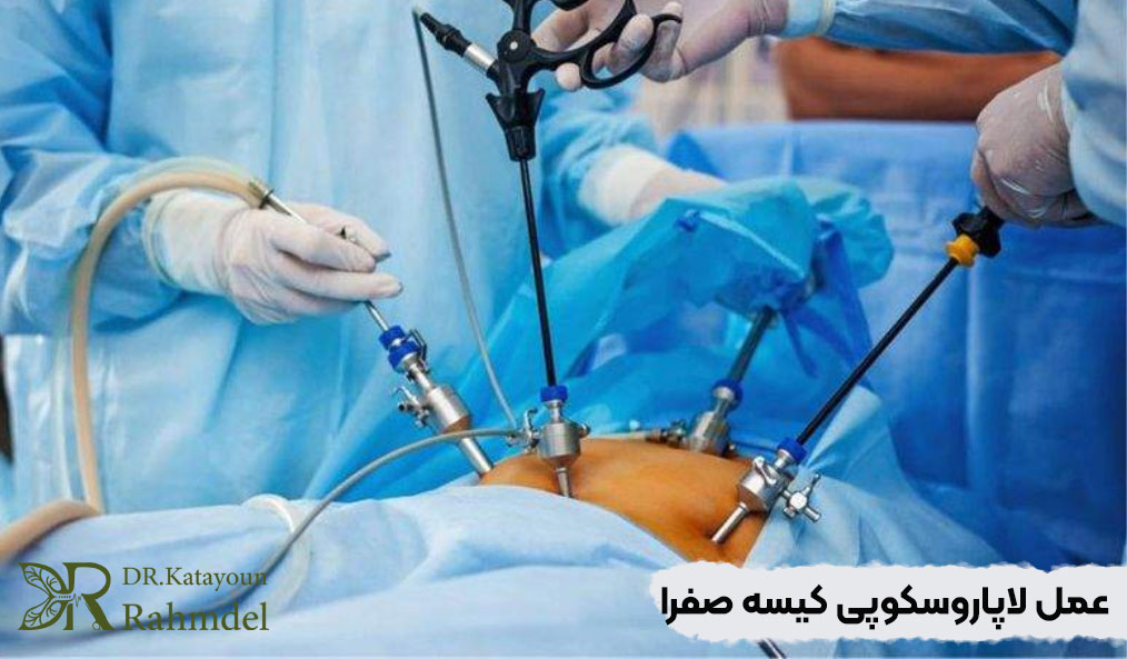 عمل جراحی کیسه صفرا